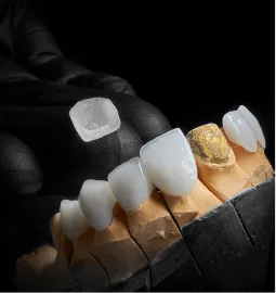 Dental Veneers