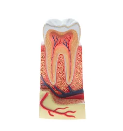Root Canal Therapy
